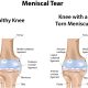 How to heal a torn meniscus naturally: Effective strategies