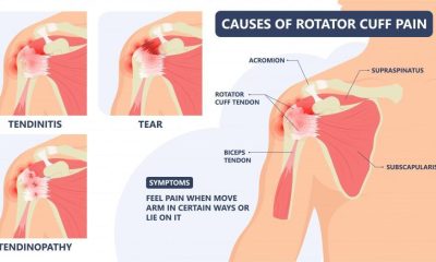 How to tell if you have a torn rotator cuff